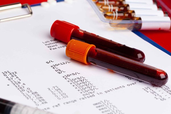 Comment les nouvelles technologies aident-elles dans le diagnostic précoce de la démence ?